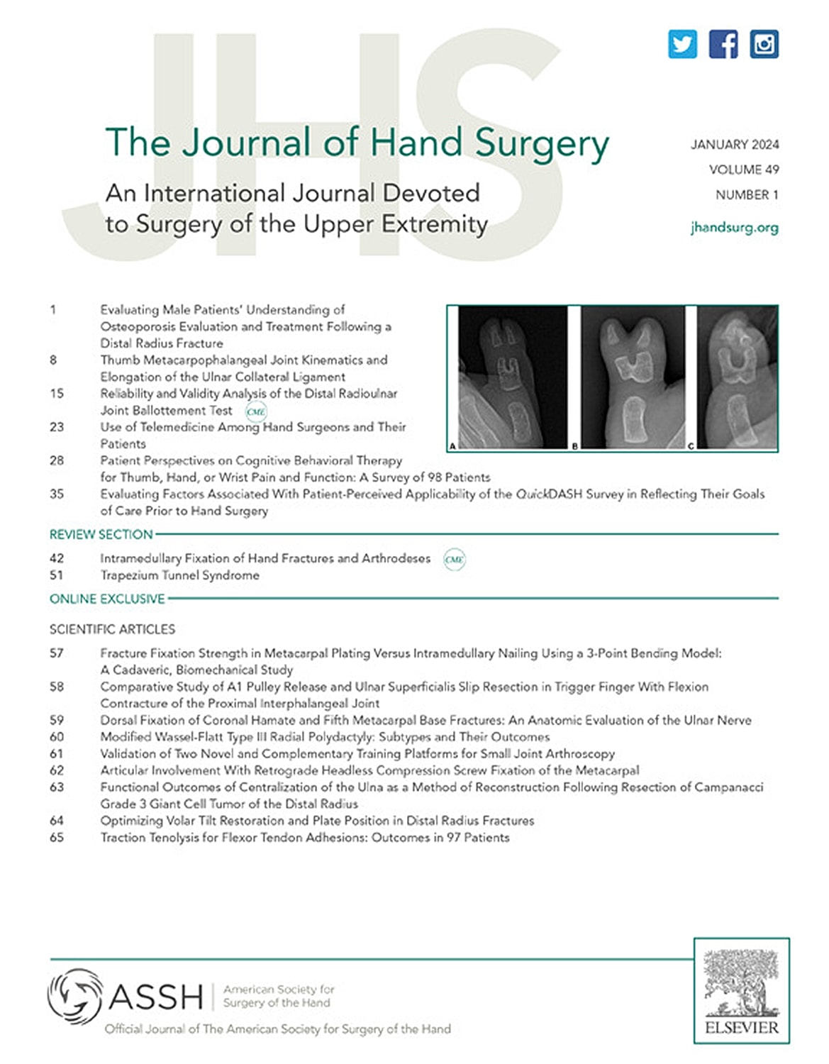 Journal cover for hand surgery research articles.
